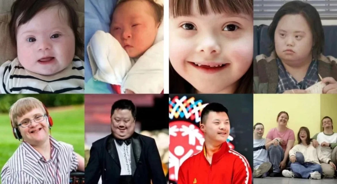 愿唐氏宝宝快乐成长!